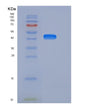 SDS-PAGE analysis of Human DDR1 (Epithelial Discoidin Domain-Containing Receptor 1) - Recombinant Protein, showing >90% purity under 15% SDS-PAGE (Reduced)
