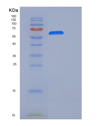 SDS-PAGE analysis of Human NCAM1 (Neural Cell Adhesion Molecule 1) - Recombinant Protein, showing >90% purity under 15% SDS-PAGE (Reduced)