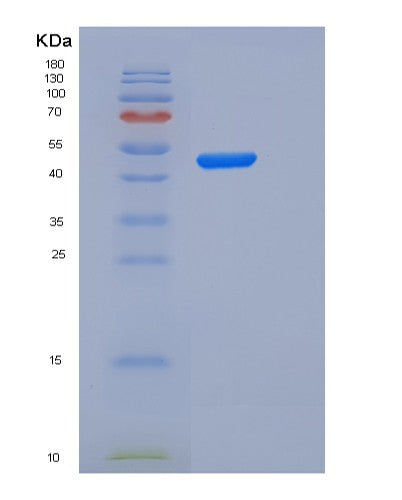 SDS-PAGE analysis of Human IL2RA (Interleukin-2 Receptor Subunit Alpha) - Recombinant Protein, showing >95% purity under 15% SDS-PAGE (Reduced)