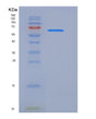 SDS-PAGE analysis of Human HNMT (Histamine N-Methyltransferase) - Recombinant Protein, showing >90% purity under 15% SDS-PAGE (Reduced)