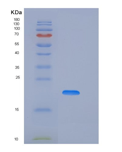 SDS-PAGE analysis of Human NCR2 (Natural Cytotoxicity Triggering Receptor 2) - Recombinant Protein, showing >85% purity under 15% SDS-PAGE (Reduced)