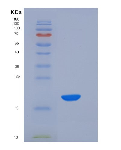 SDS-PAGE analysis of Mouse Nbl1 (Neuroblastoma Suppressor Of Tumorigenicity 1) - Recombinant Protein, showing >90% purity under 15% SDS-PAGE (Reduced)