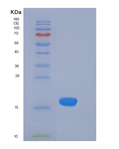 SDS-PAGE analysis of Human CST4 (Cystatin-S) - Recombinant Protein, showing >90% purity under 15% SDS-PAGE (Reduced)