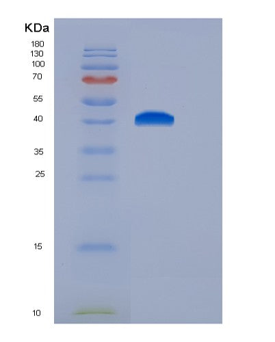 SDS-PAGE analysis of Mouse Ctse (Cathepsin E) - Recombinant Protein, showing >95% purity under 15% SDS-PAGE (Reduced)