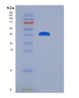 SDS-PAGE analysis of Mouse Ctse (Cathepsin E) - Recombinant Protein, showing >95% purity under 15% SDS-PAGE (Reduced)
