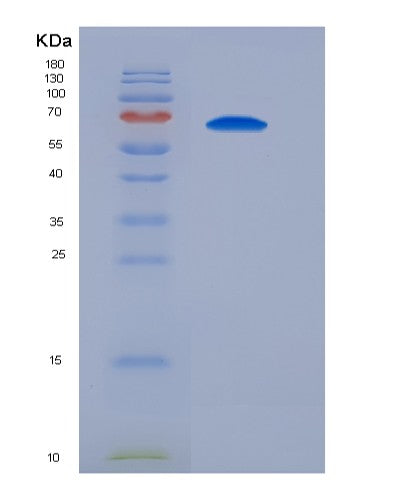SDS-PAGE analysis of Mouse Sirpa (Tyrosine-Protein Phosphatase Non-Receptor Type Substrate 1) - Recombinant Protein, showing >90% purity under 15% SDS-PAGE (Reduced)