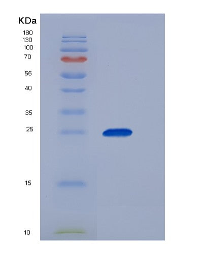 SDS-PAGE analysis of Human CFD (Complement Factor D) - Recombinant Protein, showing >95% purity under 15% SDS-PAGE (Reduced)