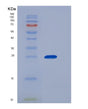 SDS-PAGE analysis of Human CFD (Complement Factor D) - Recombinant Protein, showing >95% purity under 15% SDS-PAGE (Reduced)