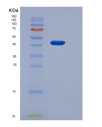SDS-PAGE analysis of Human F7 (Coagulation Factor Vii) - Recombinant Protein, showing >85% purity under 15% SDS-PAGE (Reduced)