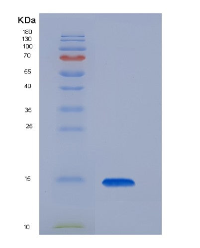 SDS-PAGE analysis of Mouse TIGIT - Recombinant Protein, CAT# BLT-08429P showing >85% purity under 15% SDS-PAGE (Reduced)