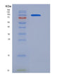 SDS-PAGE analysis of Human APP (Amyloid-Beta Precursor Protein) - Recombinant Protein, showing >95% purity under 15% SDS-PAGE (Reduced)