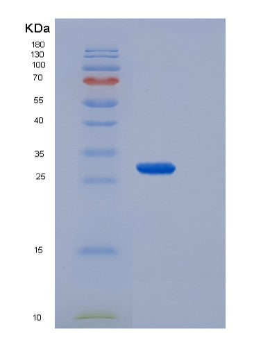SDS-PAGE analysis of Human PLAT (Tissue-Type Plasminogen Activator) - Recombinant Protein, showing >90% purity under 15% SDS-PAGE (Reduced)