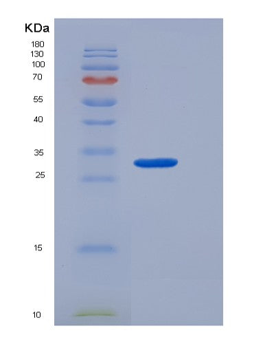 SDS-PAGE analysis of Human CTRC (Chymotrypsin-C) - Recombinant Protein, showing >95% purity under 15% SDS-PAGE (Reduced)