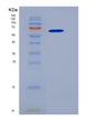 SDS-PAGE analysis of Human IL1RAPL2 (X-Linked Interleukin-1 Receptor Accessory Protein-Like 2) - Recombinant Protein, showing >95% purity under 15% SDS-PAGE (Reduced)