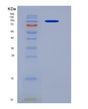 SDS-PAGE analysis of Human TEK (Angiopoietin-1 Receptor) - Recombinant Protein, showing >95% purity under 15% SDS-PAGE (Reduced)