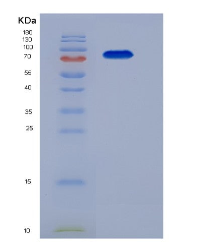 SDS-PAGE analysis of Mouse Tgfbr3 (Transforming Growth Factor Beta Receptor Type 3) - Recombinant Protein, showing >85% purity under 15% SDS-PAGE (Reduced)