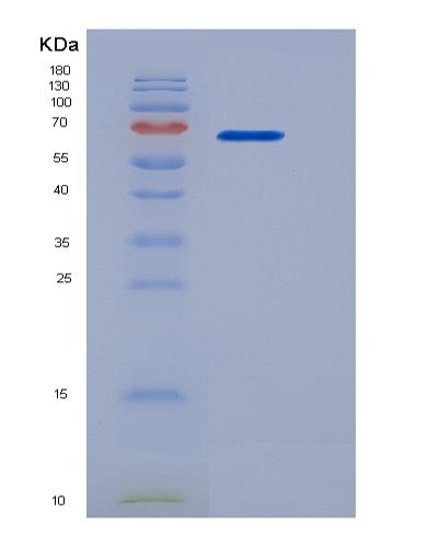 SDS-PAGE analysis of Human CD180 (Cd180 Antigen) - Recombinant Protein, showing >95% purity under 15% SDS-PAGE (Reduced)
