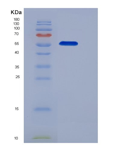 SDS-PAGE analysis of Mouse Kit (Mast/Stem Cell Growth Factor Receptor Kit) - Recombinant Protein, showing >95% purity under 15% SDS-PAGE (Reduced)