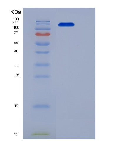 SDS-PAGE analysis of Human MET (Hepatocyte Growth Factor Receptor) - Recombinant Protein, showing >95% purity under 15% SDS-PAGE (Reduced)