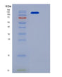 SDS-PAGE analysis of Human MET (Hepatocyte Growth Factor Receptor) - Recombinant Protein, showing >95% purity under 15% SDS-PAGE (Reduced)