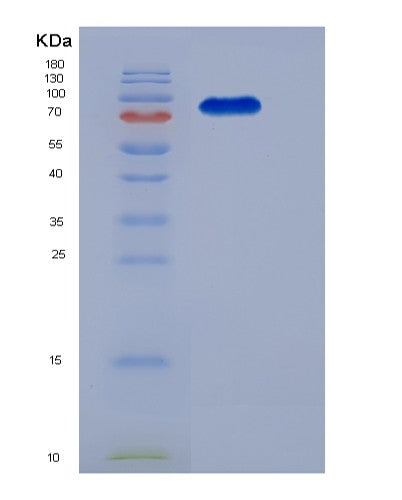 SDS-PAGE analysis of Mouse Kit (Mast/Stem Cell Growth Factor Receptor Kit) - Recombinant Protein, showing >85% purity under 15% SDS-PAGE (Reduced)