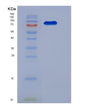 SDS-PAGE analysis of Mouse Kit (Mast/Stem Cell Growth Factor Receptor Kit) - Recombinant Protein, showing >85% purity under 15% SDS-PAGE (Reduced)