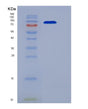 SDS-PAGE analysis of Human ENPP2 (Autotaxin) - Recombinant Protein, showing >95% purity under 15% SDS-PAGE (Reduced)