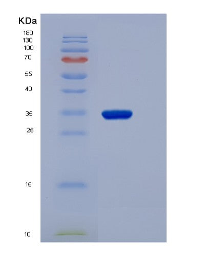 SDS-PAGE analysis of Human NMNAT1 (Nicotinamide/Nicotinic Acid Mononucleotide Adenylyltransferase 1) - Recombinant Protein, showing >85% purity under 15% SDS-PAGE (Reduced)