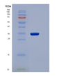 SDS-PAGE analysis of Human NMNAT1 (Nicotinamide/Nicotinic Acid Mononucleotide Adenylyltransferase 1) - Recombinant Protein, showing >85% purity under 15% SDS-PAGE (Reduced)