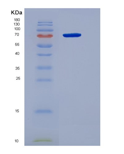 SDS-PAGE analysis of Human GPNMB (Transmembrane Glycoprotein Nmb) - Recombinant Protein, showing >90% purity under 15% SDS-PAGE (Reduced)