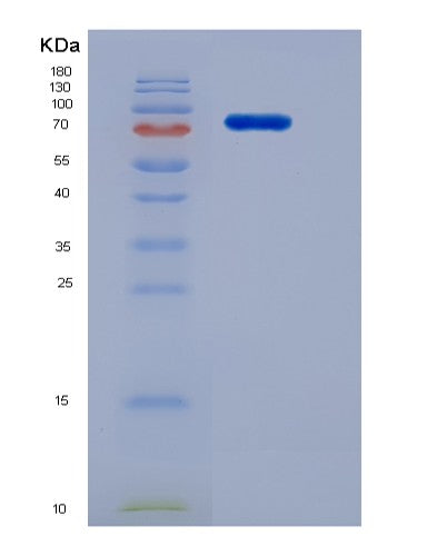SDS-PAGE analysis of Human FLT1 (Vascular Endothelial Growth Factor Receptor 1) - Recombinant Protein, showing >95% purity under 15% SDS-PAGE (Reduced)