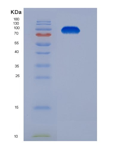 SDS-PAGE analysis of Mouse Tfrc (Transferrin Receptor Protein 1) - Recombinant Protein, showing >85% purity under 15% SDS-PAGE (Reduced)