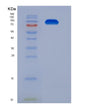 SDS-PAGE analysis of Mouse Tfrc (Transferrin Receptor Protein 1) - Recombinant Protein, showing >85% purity under 15% SDS-PAGE (Reduced)