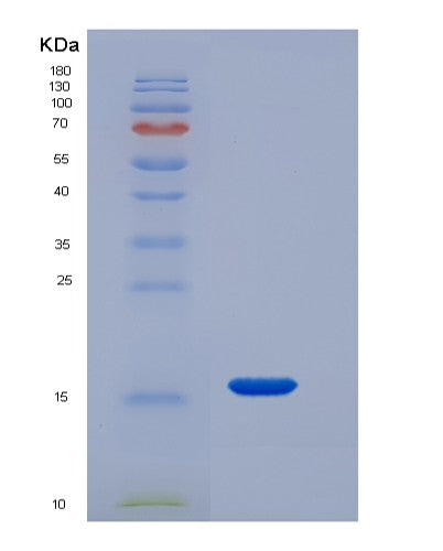 SDS-PAGE analysis of Human JCHAIN (Immunoglobulin J Chain) - Recombinant Protein, showing >95% purity under 15% SDS-PAGE (Reduced)