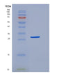 SDS-PAGE analysis of Human SULT1A3 (Sulfotransferase 1A3) - Recombinant Protein, showing >95% purity under 15% SDS-PAGE (Reduced)