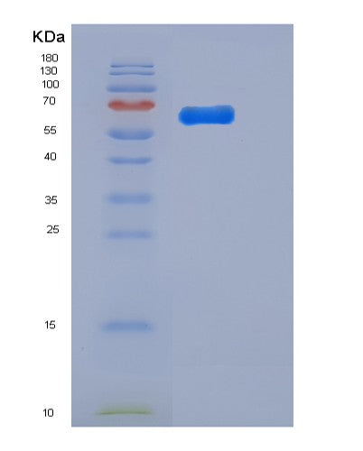 SDS-PAGE analysis of Mouse Tlr2 (Toll-Like Receptor 2) - Recombinant Protein, showing >90% purity under 15% SDS-PAGE (Reduced)