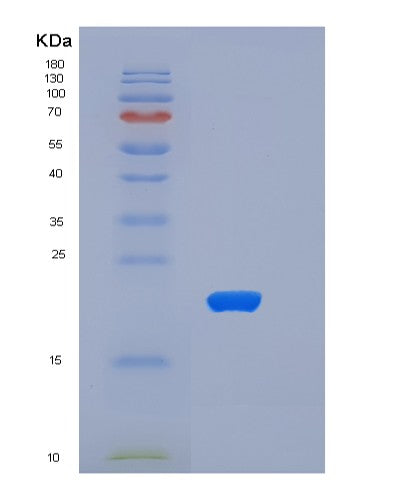 SDS-PAGE analysis of Mouse Tnfrsf1a (Tumor Necrosis Factor Receptor Superfamily Member 1A) - Recombinant Protein, showing >85% purity under 15% SDS-PAGE (Reduced)
