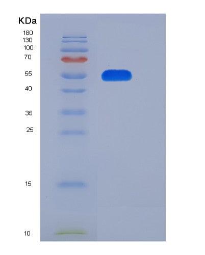 SDS-PAGE analysis of Human FLRT1 (Leucine-Rich Repeat Transmembrane Protein Flrt1) - Recombinant Protein, showing >85% purity under 15% SDS-PAGE (Reduced)