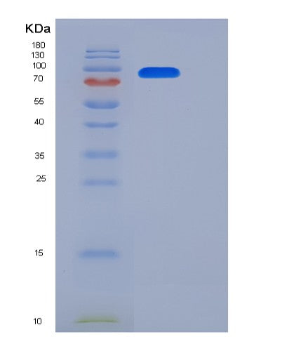 SDS-PAGE analysis of Mouse Erbb2 (Receptor Tyrosine-Protein Kinase Erbb-2) - Recombinant Protein, showing >90% purity under 15% SDS-PAGE (Reduced)
