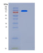 SDS-PAGE analysis of Mouse Erbb2 (Receptor Tyrosine-Protein Kinase Erbb-2) - Recombinant Protein, showing >90% purity under 15% SDS-PAGE (Reduced)