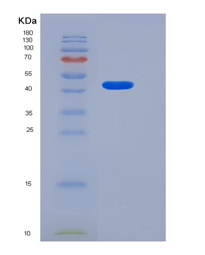 SDS-PAGE analysis of Human LRRTM4 (Leucine-Rich Repeat Transmembrane Neuronal Protein 4) - Recombinant Protein, showing >90% purity under 15% SDS-PAGE (Reduced)