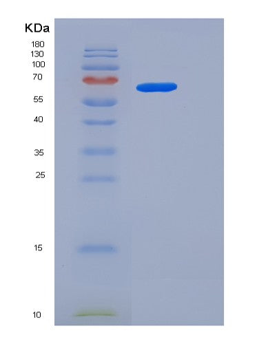 SDS-PAGE analysis of Human USH1C (Harmonin) - Recombinant Protein, showing >95% purity under 15% SDS-PAGE (Reduced)