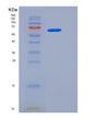 SDS-PAGE analysis of Human USH1C (Harmonin) - Recombinant Protein, showing >95% purity under 15% SDS-PAGE (Reduced)