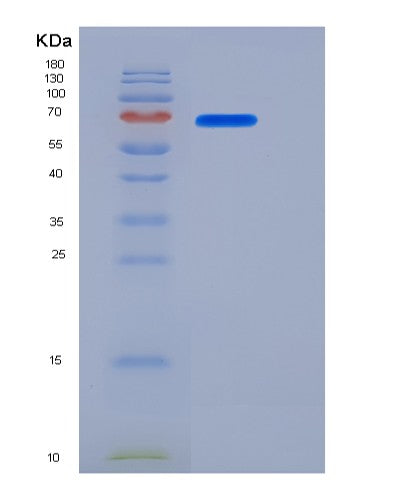SDS-PAGE analysis of Mouse Cd180 (Cd180 Antigen) - Recombinant Protein, showing >90% purity under 15% SDS-PAGE (Reduced)