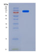SDS-PAGE analysis of Mouse Cd180 (Cd180 Antigen) - Recombinant Protein, showing >85% purity under 15% SDS-PAGE (Reduced)