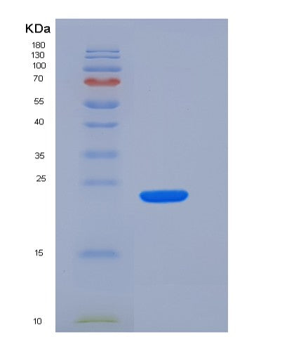 SDS-PAGE analysis of Human SLAMF7 (Slam Family Member 7) - Recombinant Protein, showing >95% purity under 15% SDS-PAGE (Reduced)