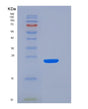 SDS-PAGE analysis of Human SLAMF7 (Slam Family Member 7) - Recombinant Protein, showing >95% purity under 15% SDS-PAGE (Reduced)