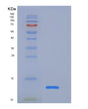 SDS-PAGE analysis of Human ACVR1B (Activin Receptor Type-1B) - Recombinant Protein, showing >85% purity under 15% SDS-PAGE (Reduced)