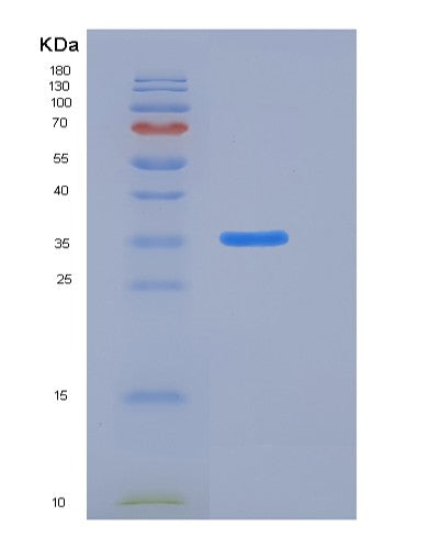 SDS-PAGE analysis of Mouse Cadm3 (Cell Adhesion Molecule 3) - Recombinant Protein, showing >90% purity under 15% SDS-PAGE (Reduced)