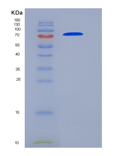 SDS-PAGE analysis of Human TGM2 (Protein-Glutamine Gamma-Glutamyltransferase 2) - Recombinant Protein, showing >90% purity under 15% SDS-PAGE (Reduced)